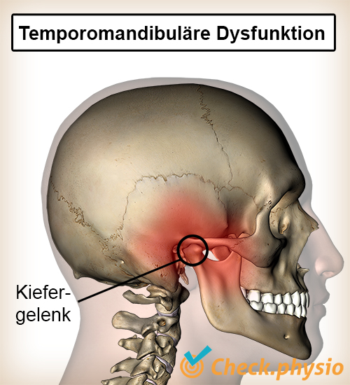 Kopf Kiefer Kiefergelenkserkrankung Kiefergelenk