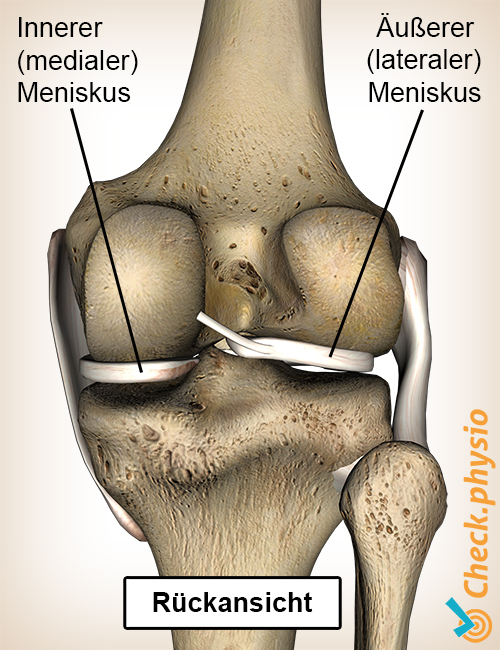 Knie Meniskus hinten