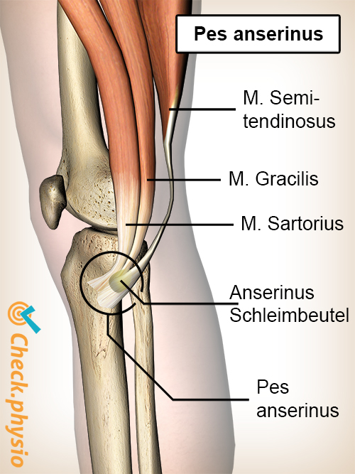 Knie Pes Anserinus Schleimbeutel Bursa Sartorius Gracilis Semitendinosus Sehnen Gänsefuß Syndrom