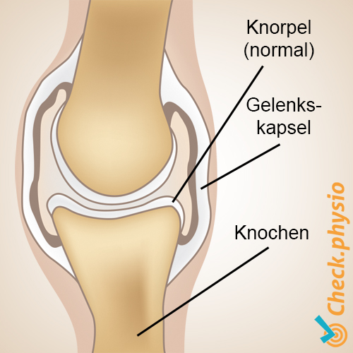 Arthrose Anatomie gesund