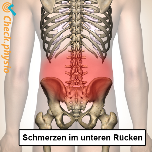 Rücken untere Rückenschmerzen Wirbelsäule Skelett