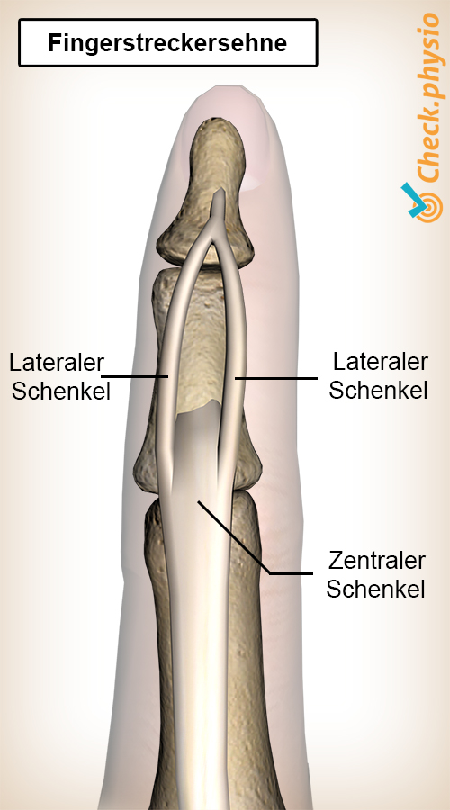 Finger Strecksehne Schlupf Zentralband Seitenband