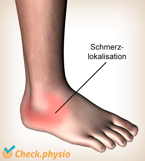 Knöchel laterale Bandverletzung Schmerzstelle Inversionstrauma