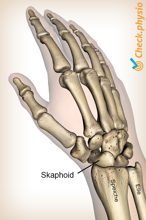 Hand Skaphoid